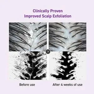 Dr. Oracle SeboClear Scalp Shampoo Rebalancing Hair & Scalp 16.9oz K-Beauty READ