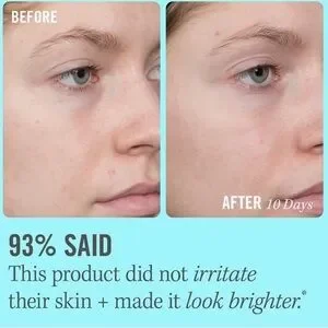 First Aid Beauty 10% Vitamin C Brightening Serum Brightens & Firms Skin 1.7 Oz